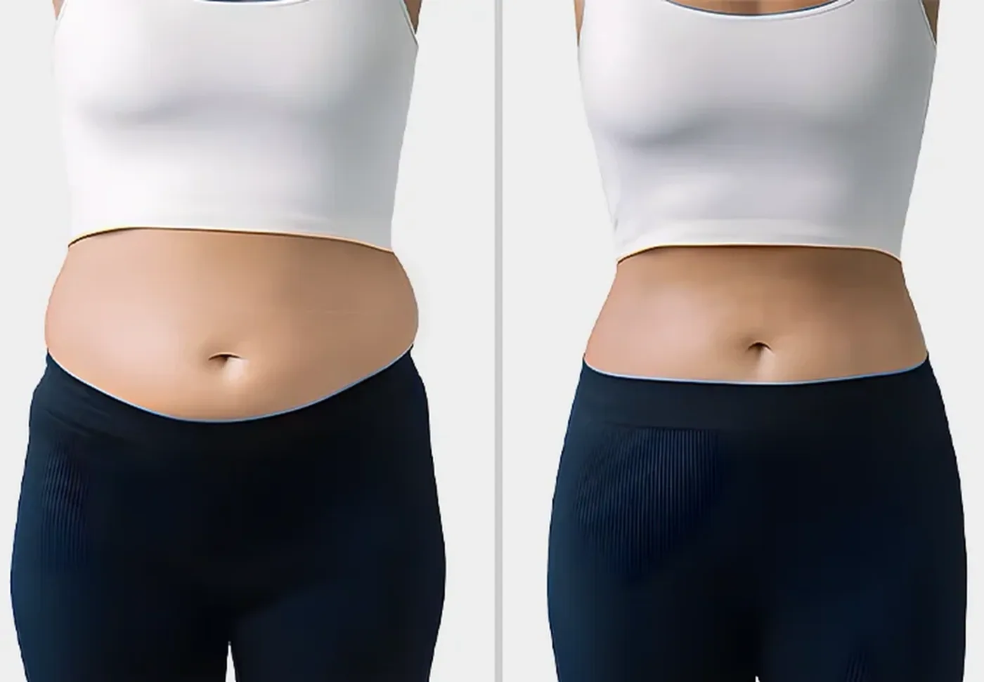 CoolSculpting®